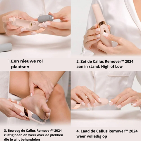 Callus Remover™ 2024 voor Stralend zachte voeten!