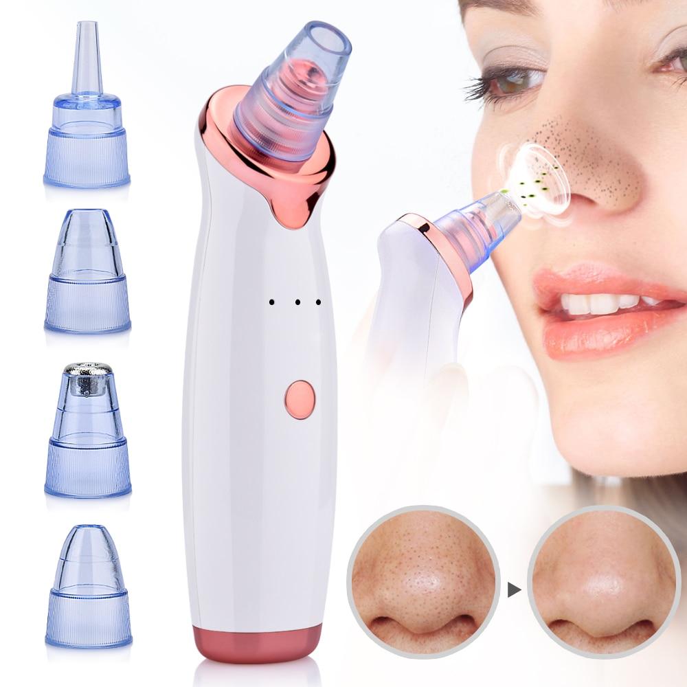 BlackHead Remover™ | Tijdelijk 1+1 GRATIS!